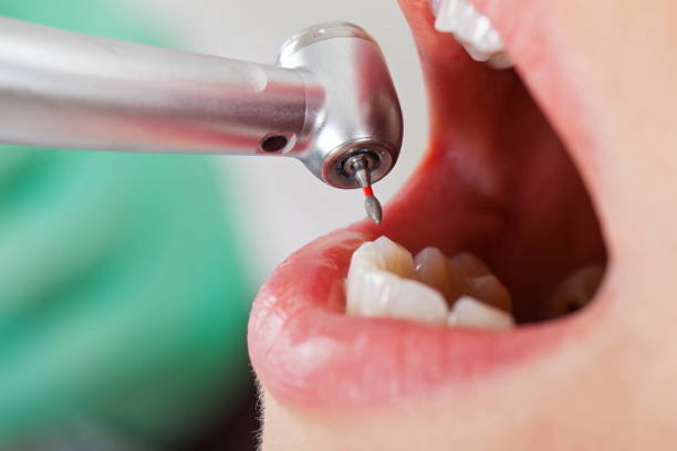 Best Emergency Dentist for Knocked-Out Tooth in Rossville, MD